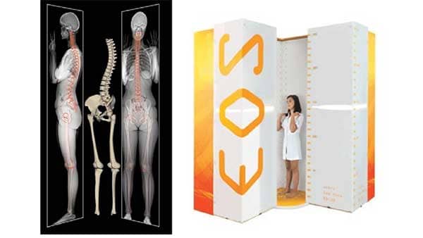 شفامد - عکس برداری سه بعدی اسکلت بدن - EOS (3D Skeletal System Imaging)